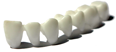 Dental prostheses