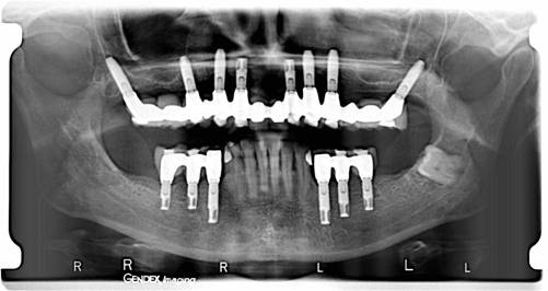 dental maintenance