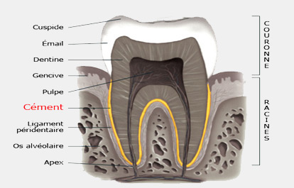 periodontal disease