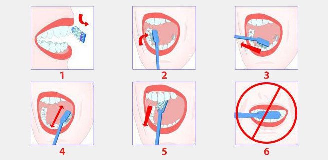 Brossage des dents 