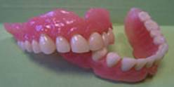 Dental prostheses