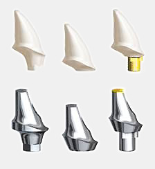 Dental prostheses